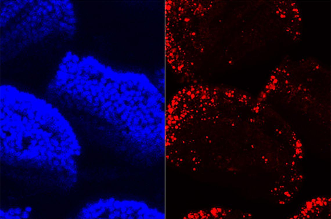 A confocal microscopy image of villi in the small intestine shows cell nuclei in blue and absorbed dietary fat in red