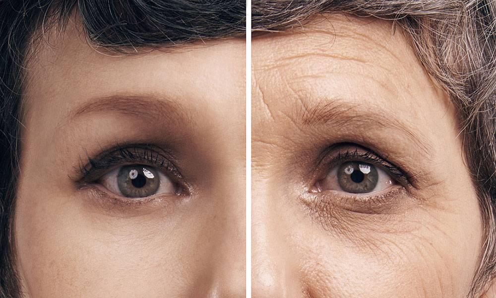 split picture of face of person showing wrinkles on right half of face