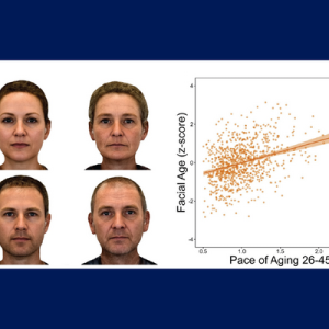  Left side: four faces. Top row has side by side female faces. left picture younger, right picture older. Bottom row is side by side of male faces. left picture younger, right picture older. Right side: a scatter graph of facial aging versus the pace of aging generally showing that the older a person looks, the faster their pace of aging.