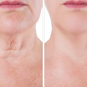 photo of two people's neck one showing aging